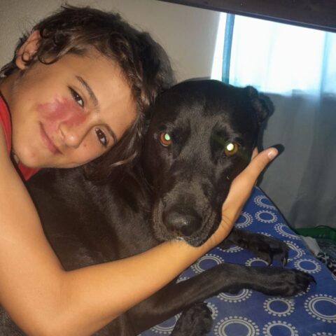 A smiling child with a red mark on their cheek hugs a black dog on a blue-patterned bedspread, both looking at the camera with sunlight coming through a window behind them.