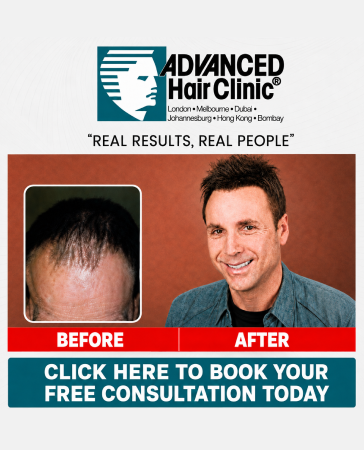 Before and after photos of a man showing hair restoration results, with Advanced Hair Clinic logo and a button to book a free consultation.